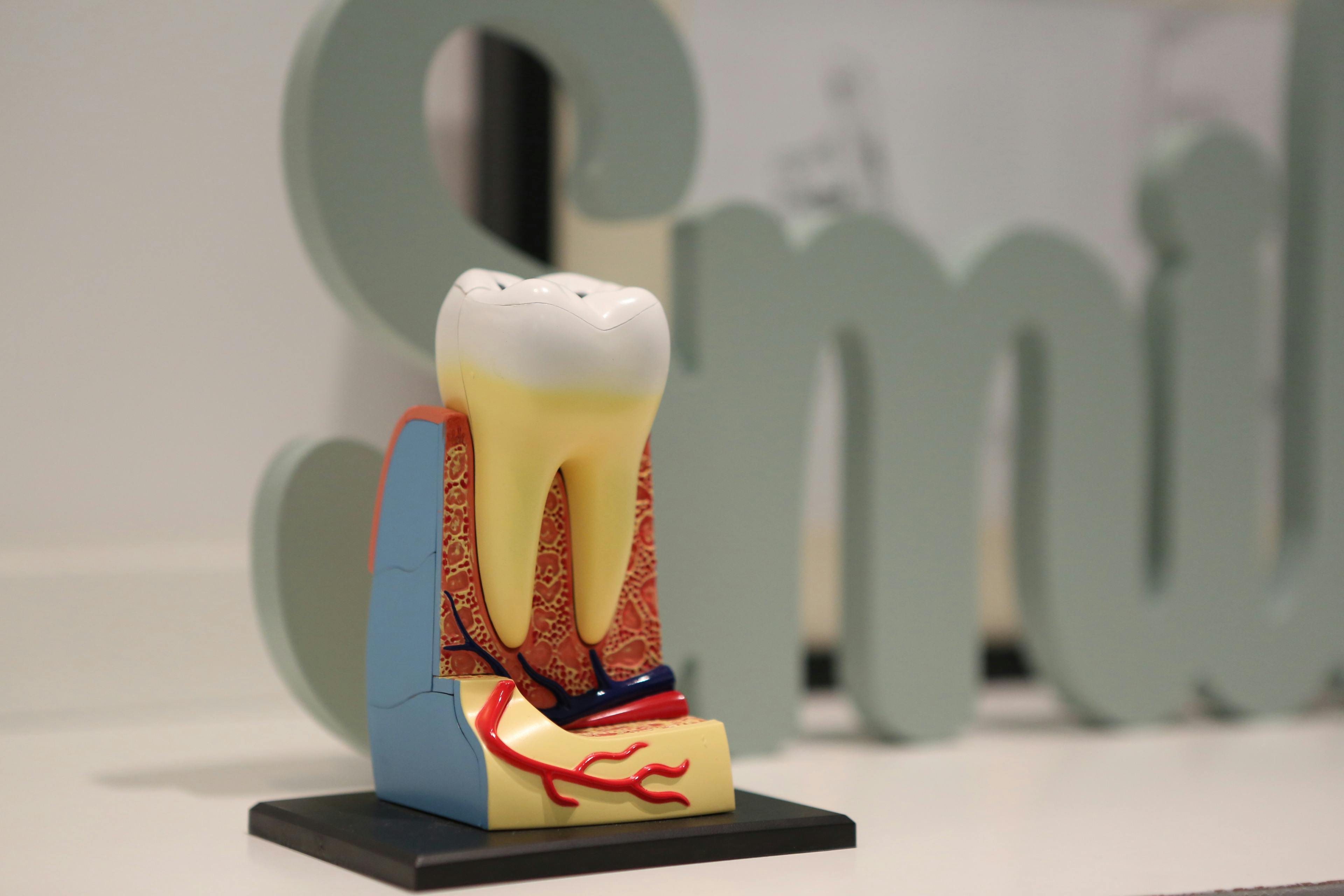 Wisdom Tooth Surgery